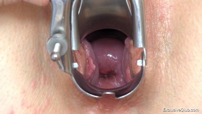 С доктором, С рыжими девушками, Гинеколог,